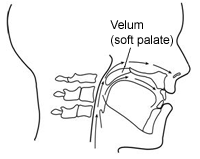 Figure 6.  Velopharyngeal incompetence (the velum doesn’t move well enough for closure).